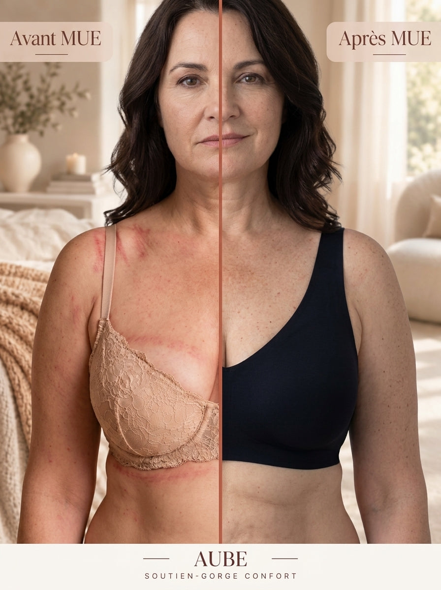 Avant / Après MUE — Soutien-gorge Aube
