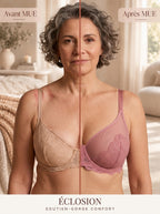 Avant / Après MUE — Soutien-gorge Éclosion