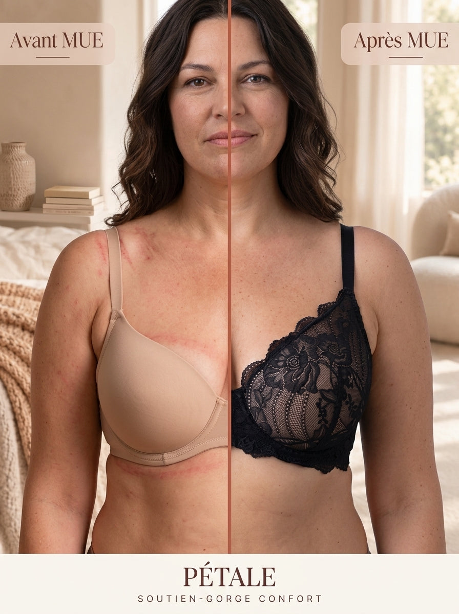 Avant / Après MUE — Soutien-gorge Pétale