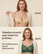 Avant / Après MUE — Soutien-gorge Rosace — format vertical mobile