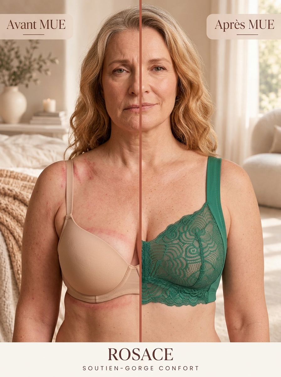 Avant / Après MUE — Soutien-gorge Rosace